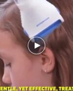 Електрически уред за премахване на въшки – video